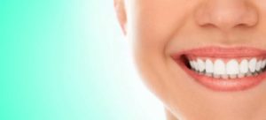 Denti perfetti